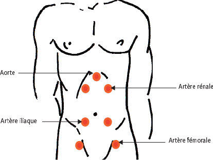 Du gauche mal du ventre coté Douleur abdominale