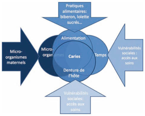diagramme de carie dentaire