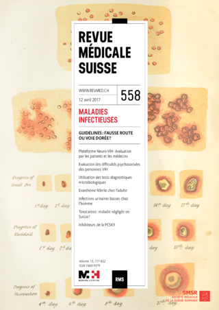 prostatitis és klebsiella