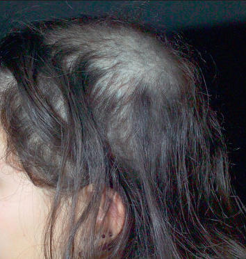 Quand Les Cheveux Se Cassent