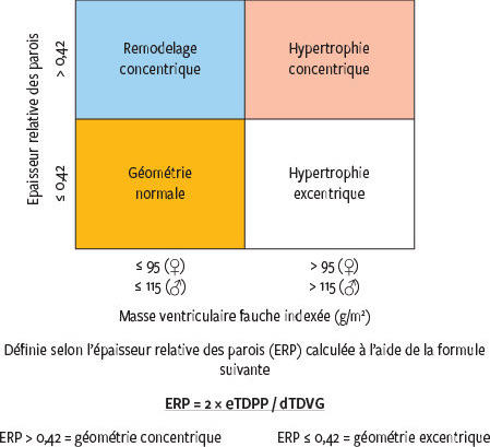 Decouverte D Une Hypertrophie Ventriculaire Gauche A L Echocardiographie Adulte Decouverte D Une Hypertrophie Ventriculaire Gauche A L Echocardiographie Adulte