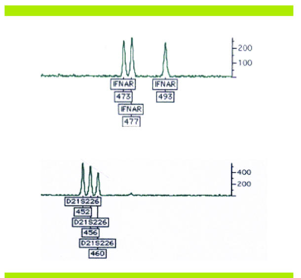 anomalies chromosomiques structurelles