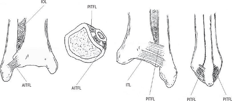boală crăpată articulară comprimați cu miere pentru dureri articulare