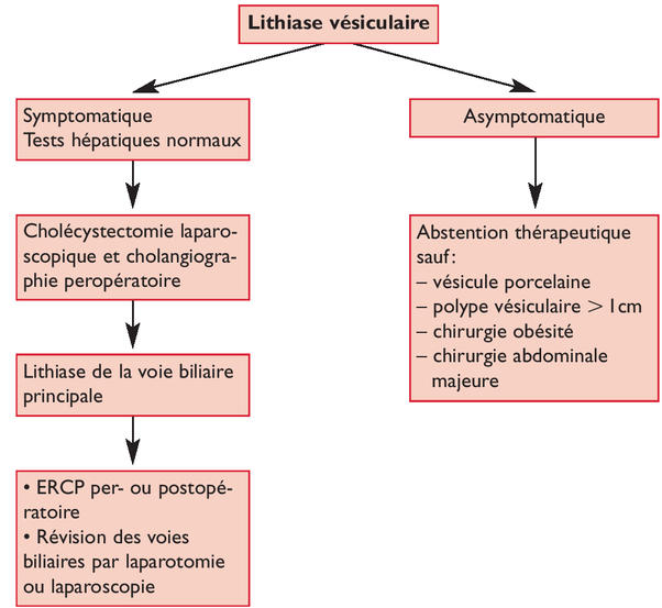 Quand faut-il réaliser une cholécystectomie ? Une décision pas ...