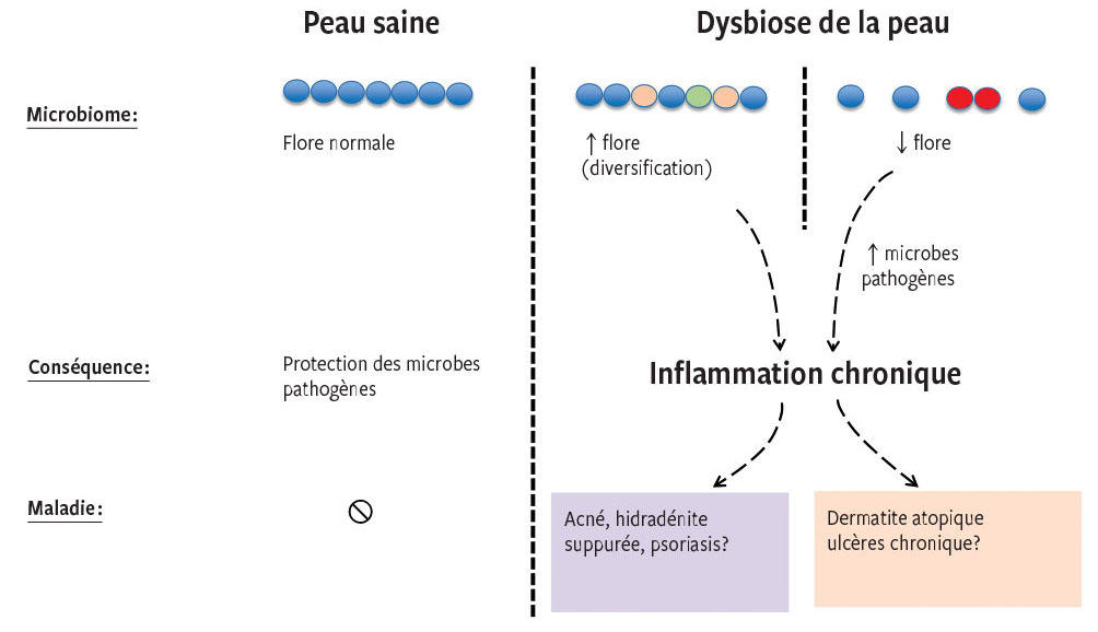 eczema RMS_512_660_fig02_i1200