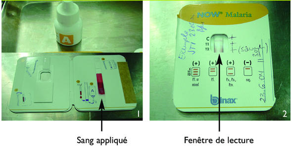 Le diagnostic de malaria au cabinet : comment gérer l'incertitude ?