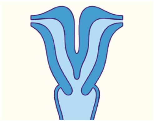 Матка у млекопитающих животных. Двурогая матка операция. Двух рогая. Аномалия матки двурогая. Двурогая седловидная матка.