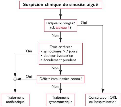 Sinusite - Traitements locaux de la sinusite aiguë
