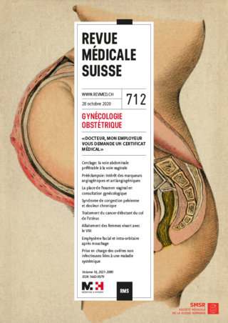 Varicoză în operațiunea pelvis mică - Mare pelvic varicoză Varicoza interna pelvis