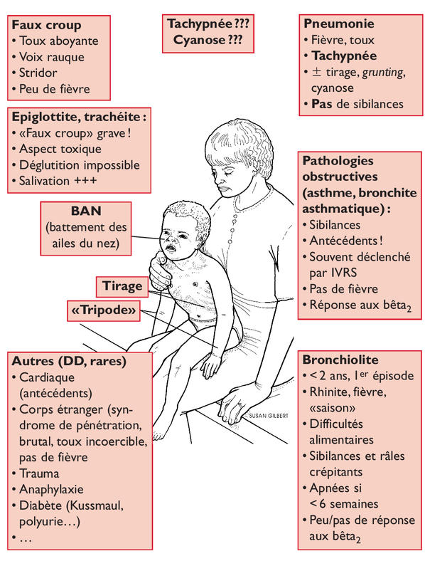 Amaigrissement de l'enfant : symptômes, traitement, définition 