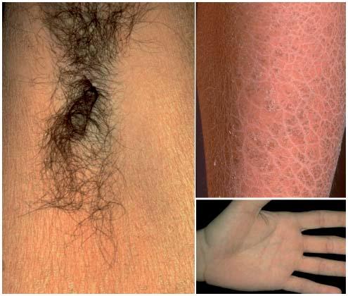 La Consultation Genetique En Dermatologie Une Approche Pratique La Consultation Genetique En Dermatologie Une Approche Pratique