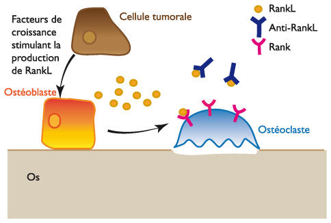 HyperQCM_Clinique hematologie