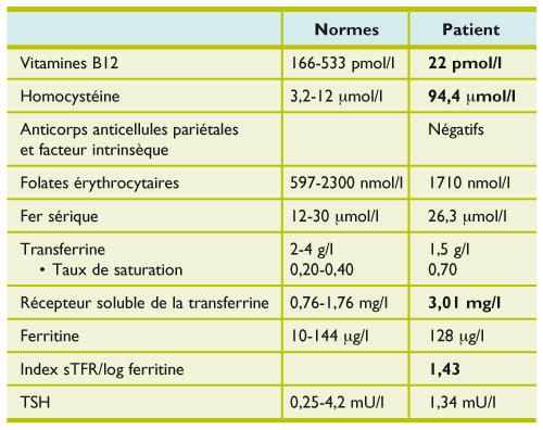 Carence Nutritionnelle Apres Bypass Gastrique Revue De La Litterature Recommandations Et Suivi Carence Nutritionnelle Apres Bypass Gastrique Revue De La Litterature Recommandations Et Suivi