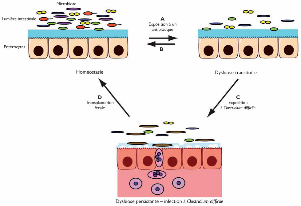 toxine a clostridium)
