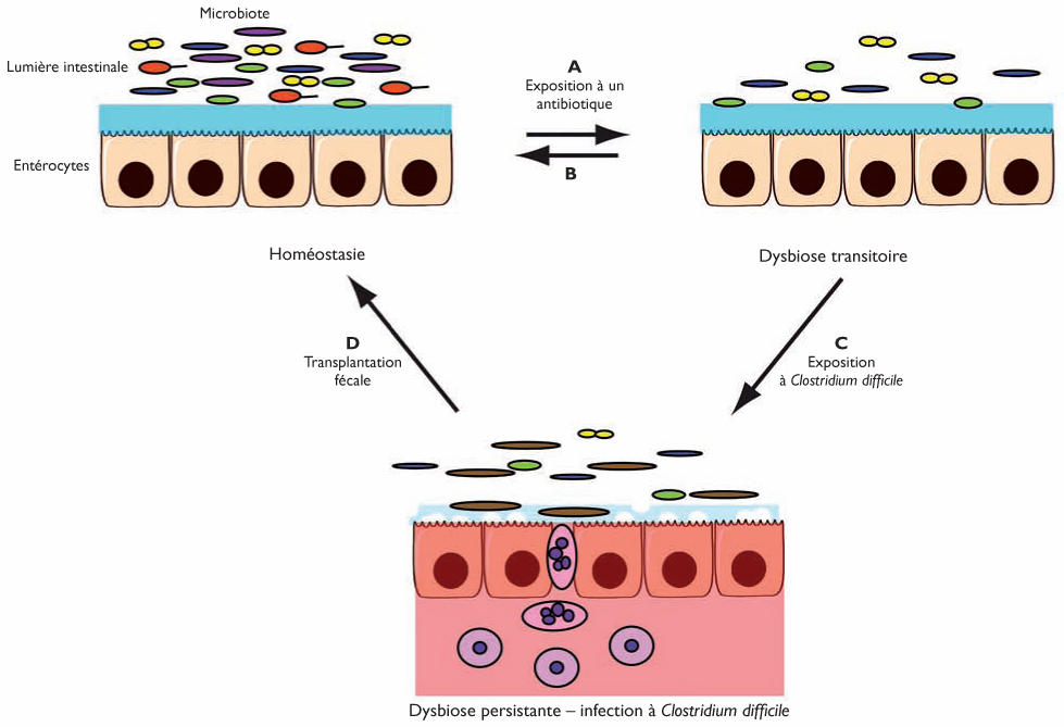 recherche toxine clostridium difficile