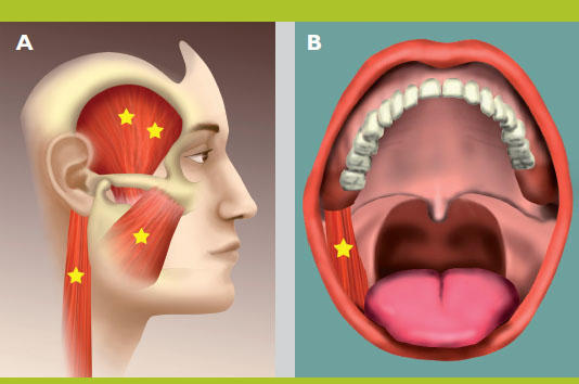 Qu'est que l'articulation temporomandibulaire ou ATM? - Soins de la bouche  - Santé Chez Nous