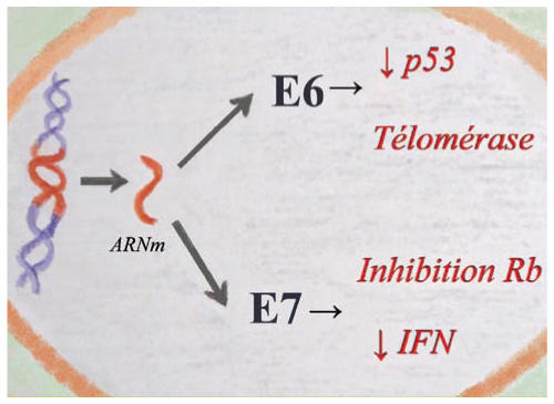 Cancerul oral: ce este, diagnostic, tratament - Virus hpv cancer orl