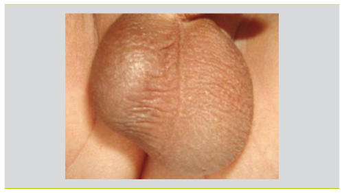 RMS_idPAS_D_ISBN_pu2011-44s_sa06_art06_img002_i1200.jpg