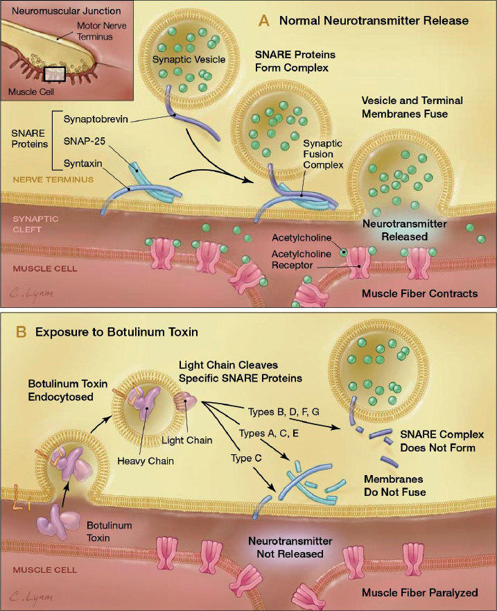 Clostridia Maitres En Toxines Le Botulisme Du Botox Au Saucisson
