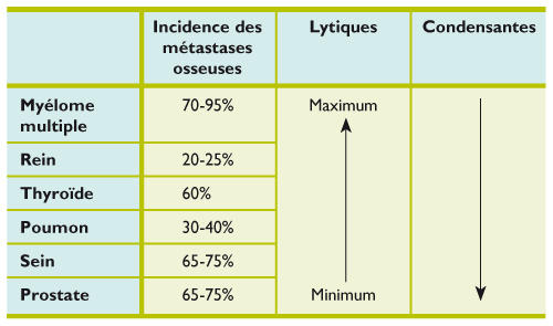 cancer prostate complications osseuses)