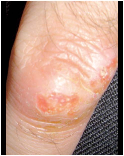 Infections Transmises Par Les Animaux Domestiques Revue Medicale Suisse