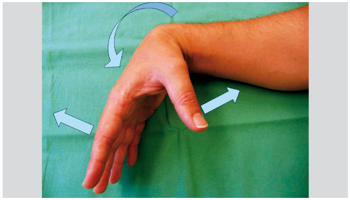 Les Plaies De La Main Revue Medicale Suisse A commissure (/ˈkɒməʃər/) is the location at which two objects abut or are joined. les plaies de la main revue medicale