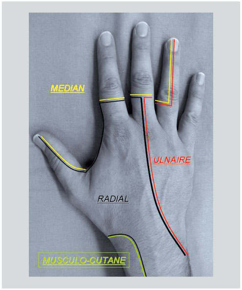 Les Plaies De La Main Revue Medicale Suisse Such a commissure is a bundle of commissural fibers as a tract that crosses the midline at its level of origin or entry (as opposed to a decussation of fibers that cross commissure also often refers to cardiac anatomy of heart valves. les plaies de la main revue medicale