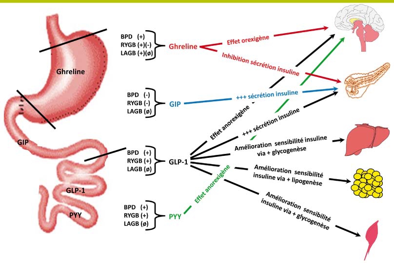 chirurgie de perte de poids de l hormone ghréline chirurgie de perte de poids de l hormone ghréline