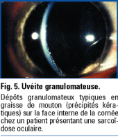 Les uvéites : approche diagnostique multi-disciplinaire à l'usage de l ...