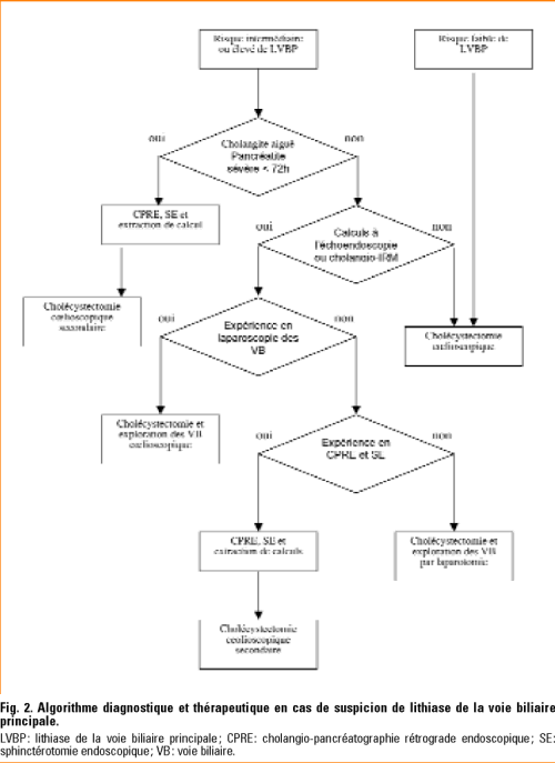 LITHIASE DE LA VOIE BILIAIRE PRINCIPALE PDF