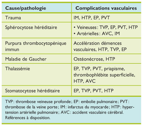 Thrombophlébite profonde Thrombophlébite profonde
