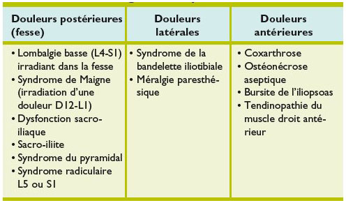 Periarthrite