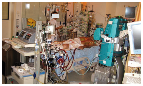 Quand Le Cœur Et Ou Les Poumons Defaillent Oxygenation
