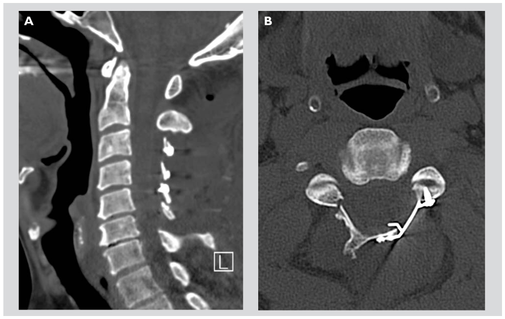 structura corpului platyhelminthes cervicale)