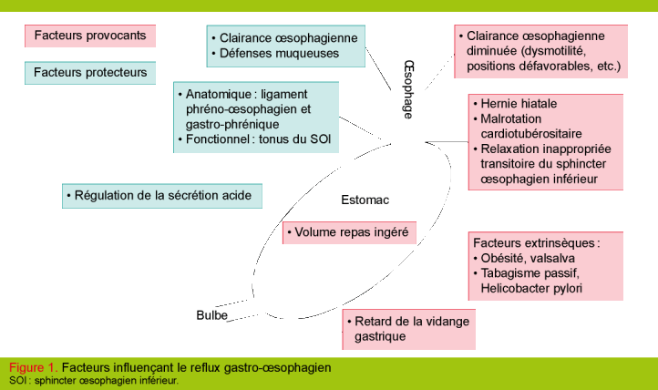 reflux gastro oesophagien symptômes reflux gastro oesophagien symptômes