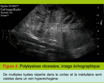 Echographie renale normale