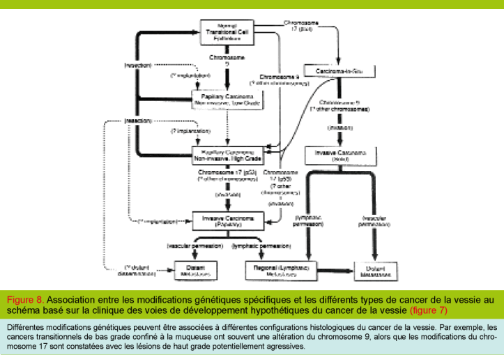Le Cancer De La Vessie Du Passe Au Futur Revue Medicale Suisse