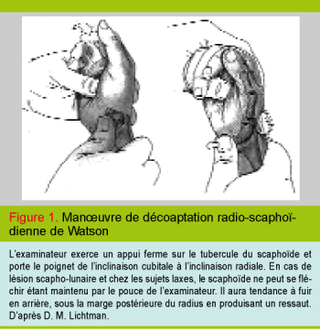 Douleur au pisiforme