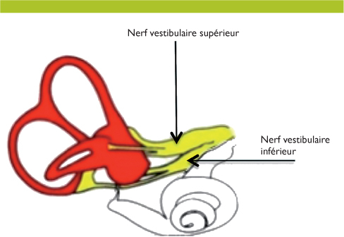 Nevrite Vestibulaire Traitement Et Pronostic Revue Medicale Suisse