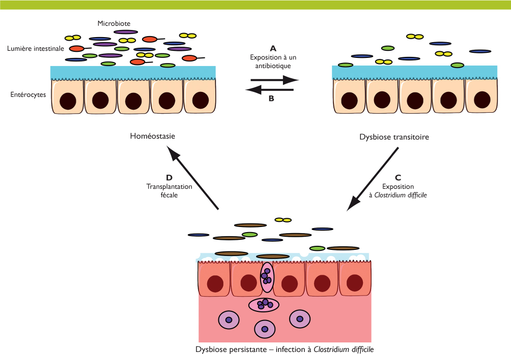 toxine b de clostridium difficile