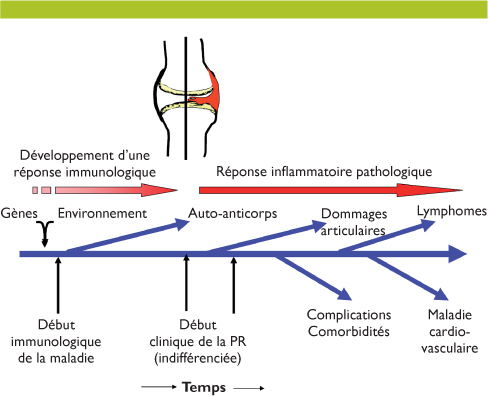 Facteurs De Risque Pour Le Developpement D Une Polyarthrite Rhumatoide Revue Medicale Suisse
