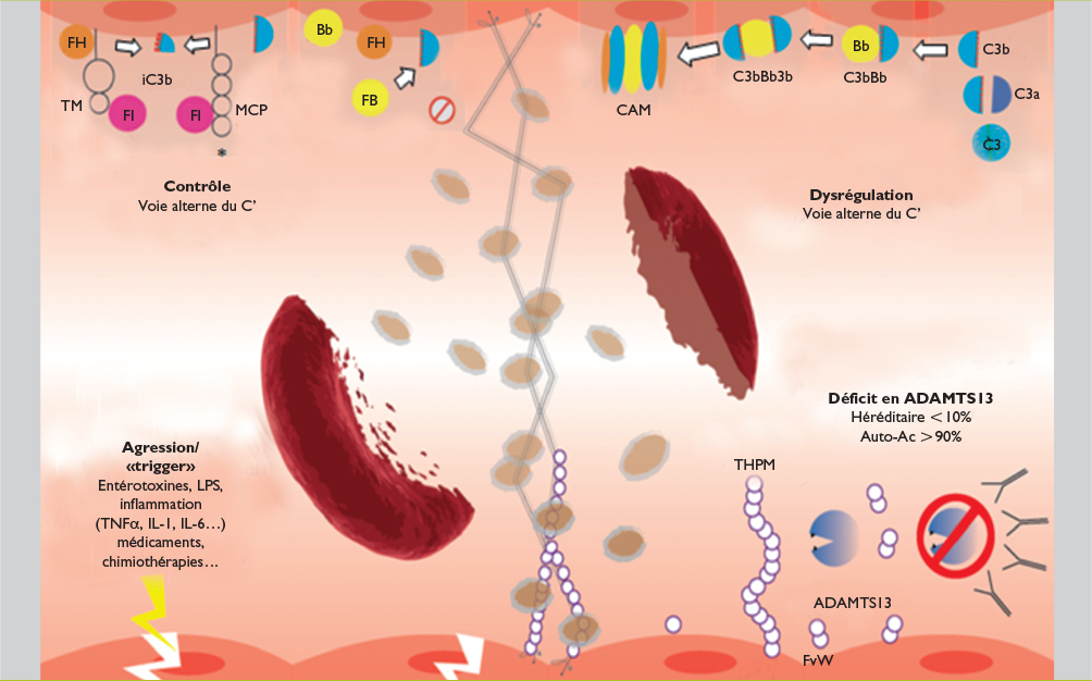 Microangiopathie thrombotique : quand le temps presse - Revue Médicale ...