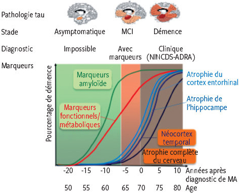 Imagerie Cerebrale De La Maladie D Alzheimer Etat De L Art Et Perspectives Pour Le Clinicien Revue Medicale Suisse