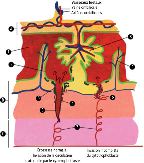 Le Placenta Nouvel Organe Cible De L Hypertension Arterielle