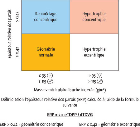 Decouverte D Une Hypertrophie Ventriculaire Gauche A L