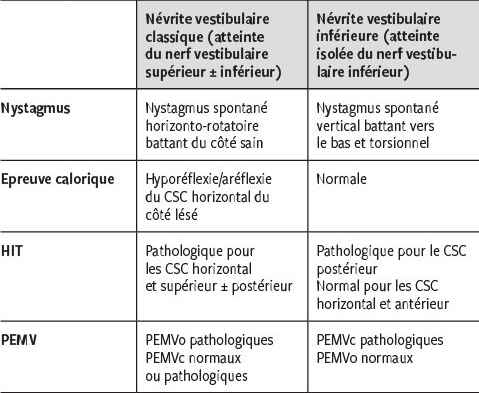 Névrite vestibulaire inférieure Revue Médicale Suisse