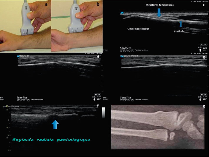 L Echographie Comme Prolongement De L Examen Clinique Du Praticien Revue Medicale Suisse